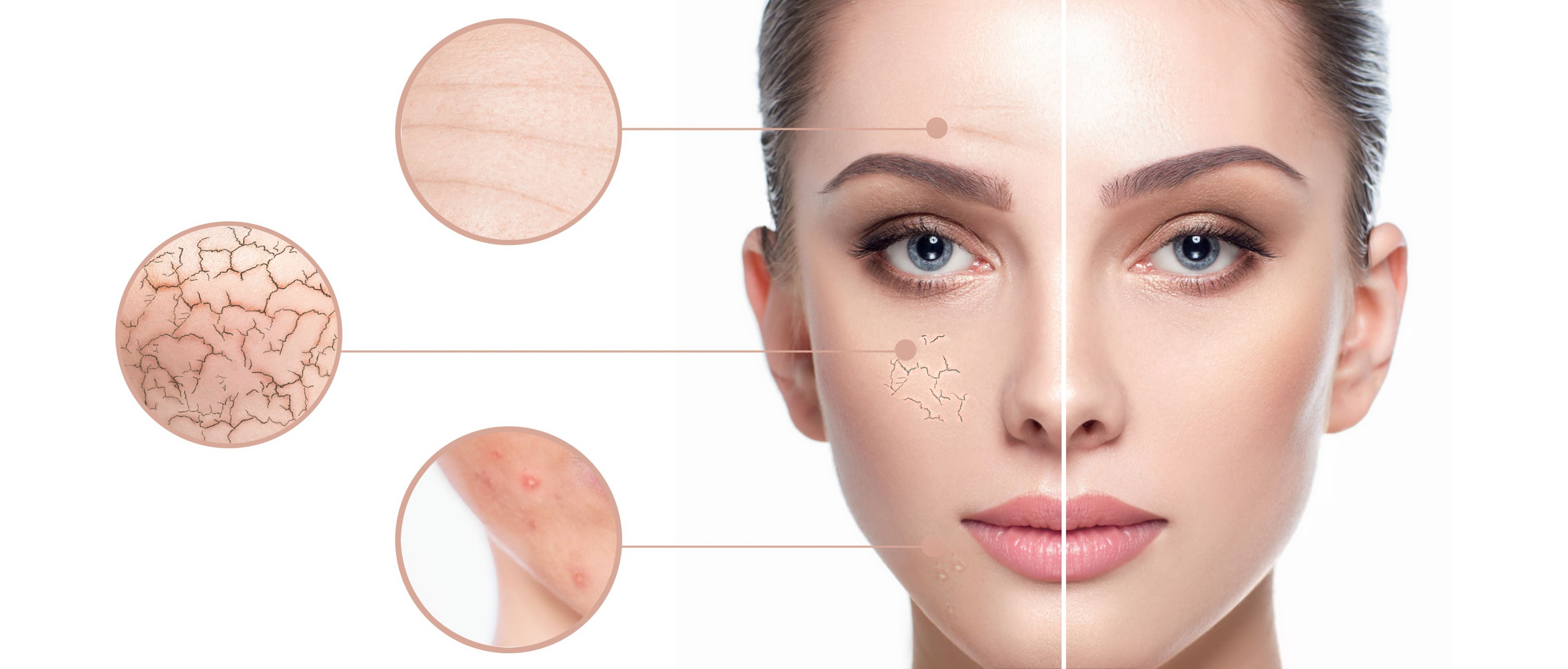 How to Treat Stressed Skin